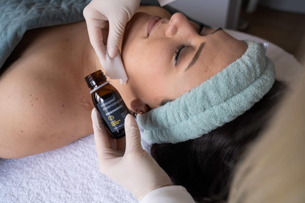 Mesopeel Jessner pro
